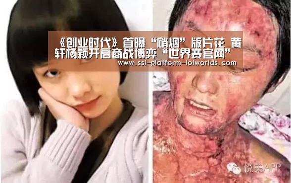 《创业时代》首曝“硝烟”版片花 黄轩杨颖开启商战博弈“世界赛官网”(图2) 全球总决赛官网